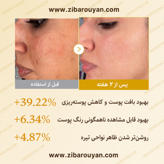 تونر لایه بردار و روشن کننده کوجیک اسید و زردچوبه مدی کیوب