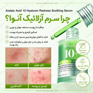 سرم تسکین دهنده قرمزی آزلائیک اسید 10% و هیالورون آنوا