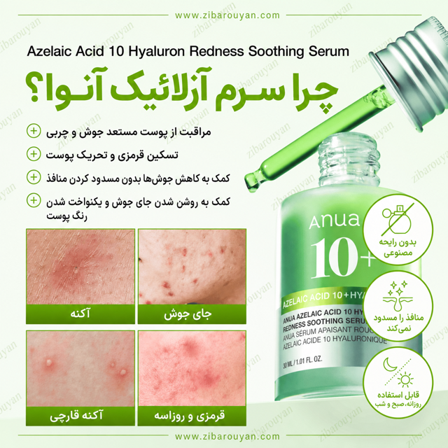 سرم تسکین دهنده قرمزی آزلائیک اسید 10% و هیالورون آنوا