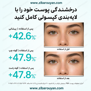 میست کپسولی آبرسان هیالورونیک و PDRN آنوا