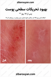ترمیم کننده سیکاپلاست لاروش پوزای