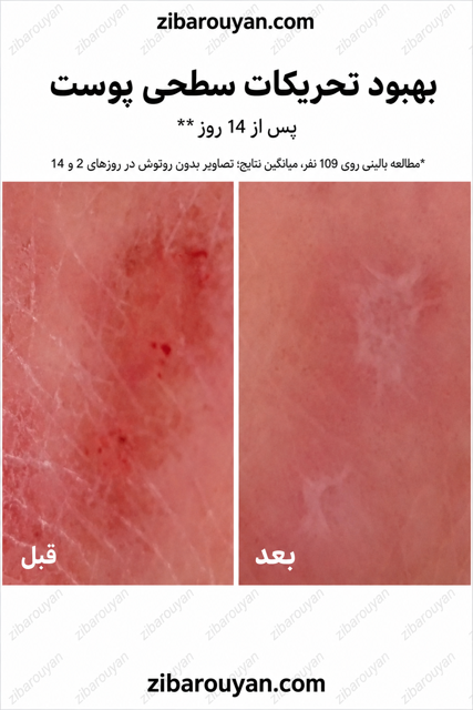 ترمیم کننده سیکاپلاست لاروش پوزای