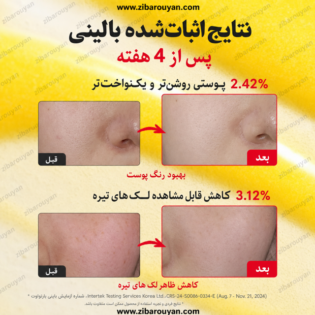 سرم ضد لک ویتامینه اکوال بری