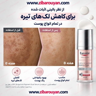 سرم ضد لک تیامیدول اوسرین