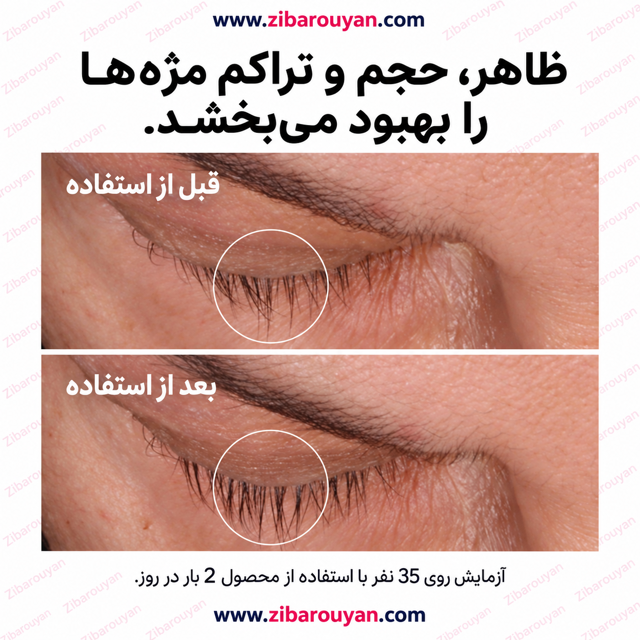 سرم تقویت مژه و ابرو اوردینری