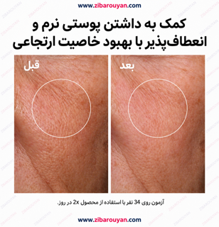 سرم آبرسان هیالورونیک اسید اوردینری