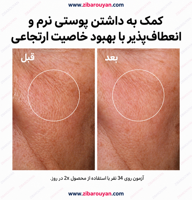 سرم آبرسان هیالورونیک اسید اوردینری